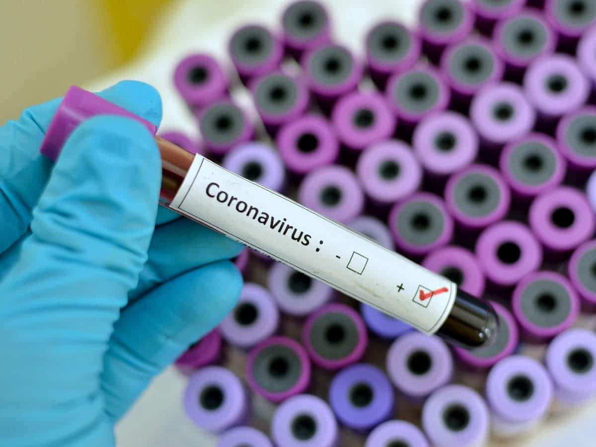 ‘Coronavirus Not A Threat But Reality In Africa’ – WHO