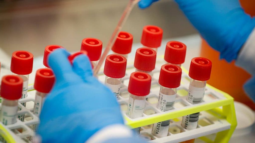 Scientist Reveals When Covid-19 Vaccine Could Be Ready
