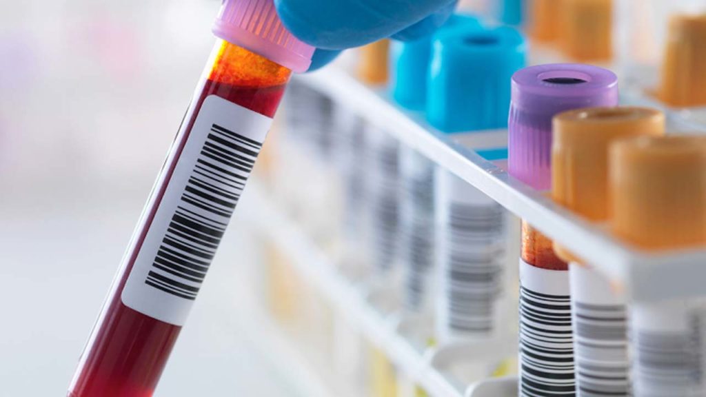 100,000 Daily New HIV Infections In Nigeria, NGO Raises Alarm