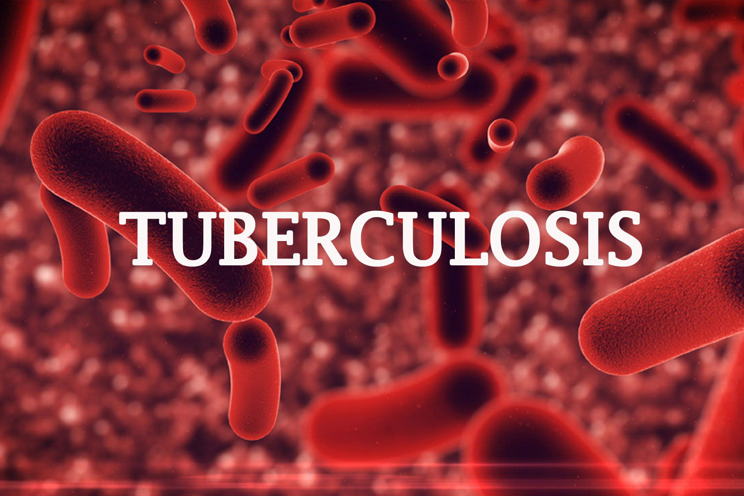 Nigeria's TB Cases On Steady Decline, WHO Announces