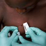 Monkeypox Scare On Rise As WHO Confirms 12 Countries 