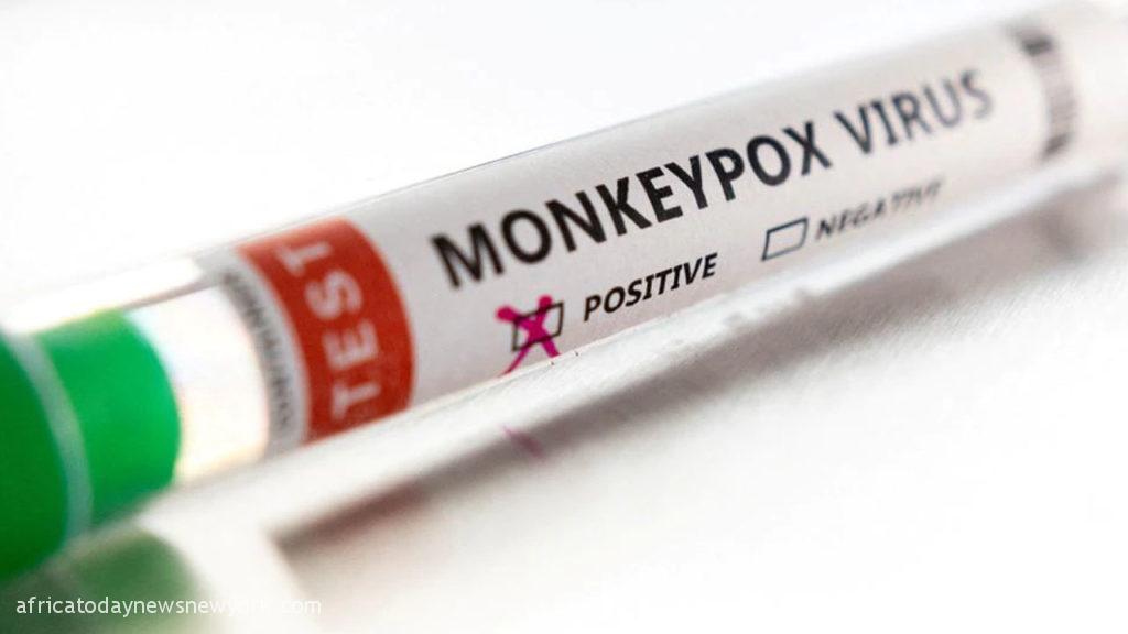 First Monkeypox Case In Sudan Reported, WHO Reacts