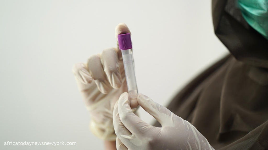 New Strains Of Sexually Transmitted Diseases Found In Kenya