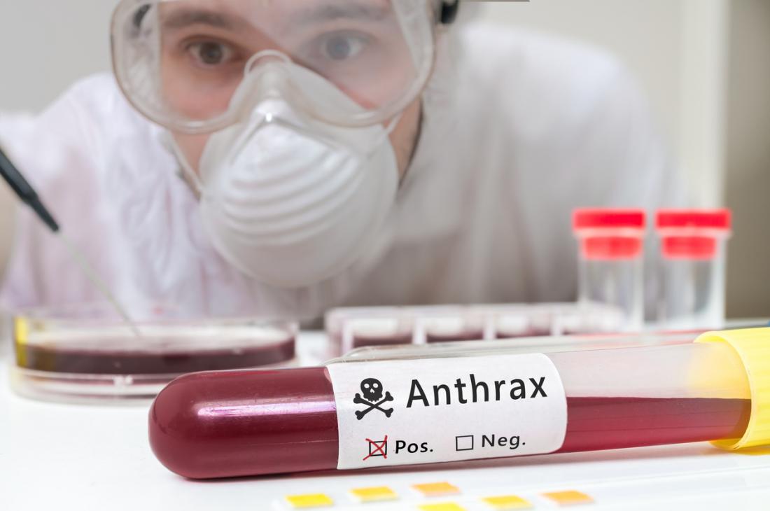 NCDC Urges Vigilance As Anthrax Spreads