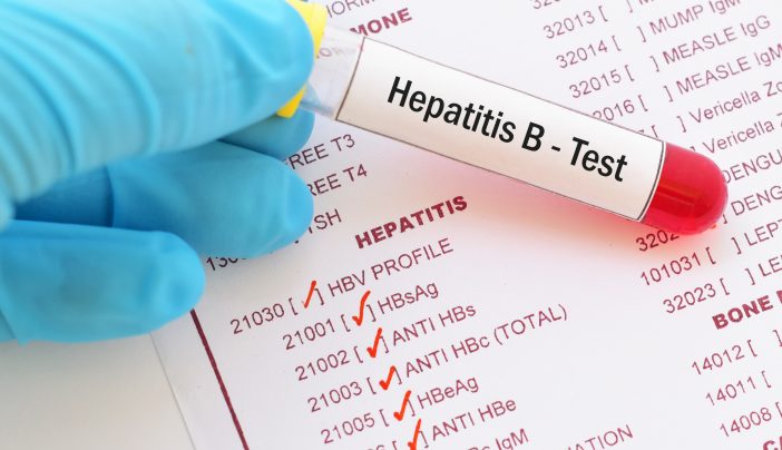 Hepatitis B Spreads Faster Than HIV, Expert Says