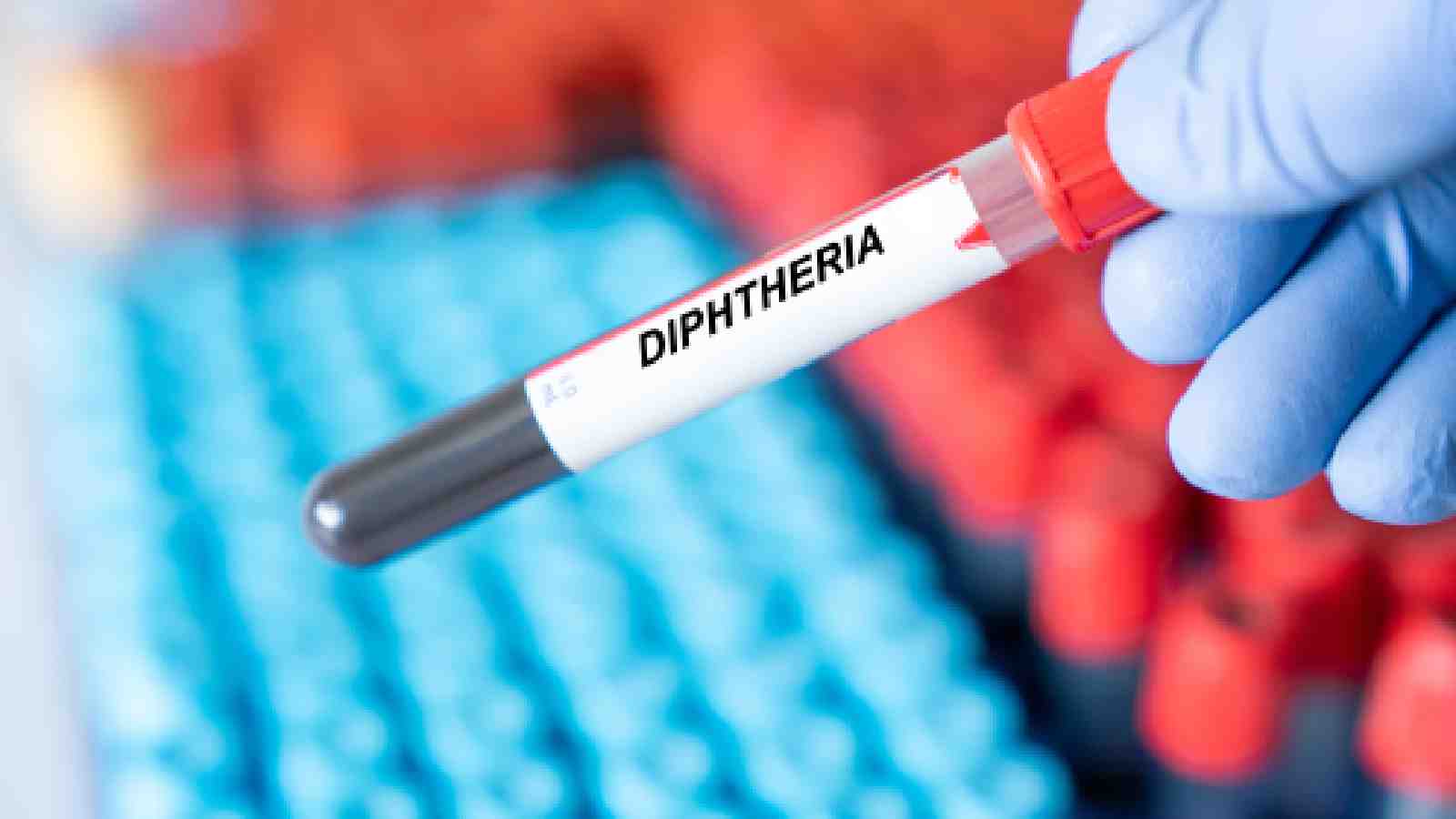 Nigeria's Diphtheria Outbreak: UNICEF Confirms 122 Death