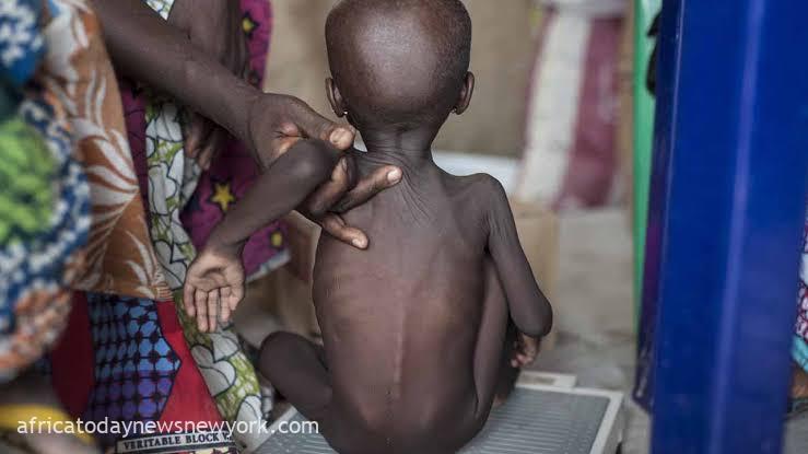 Malnutrition Crisis: Child Mortality Surges In North