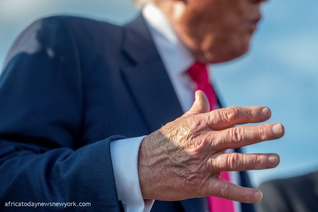 Trump’s Swollen Leg, Bruised Hand Linked To Vein Complication
