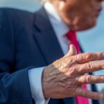 Trump’s Swollen Leg, Bruised Hand Linked To Vein Complication