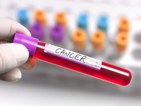 Breakthrough Blood Test Detects 50 Cancer Types