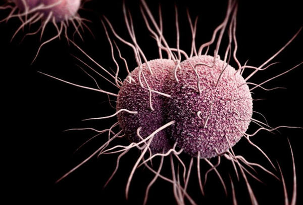 Drug-Resistant Gonorrhoea Spreading, WHO Cautions